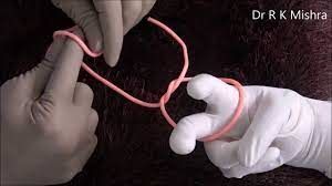 How to do Safe Laparoscopic Orchidopexy - Lecture by Dr R K Mishra