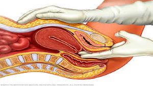 Laparoscopic Management of Genitourinary Prolapse Lecture by Dr R K Mishra