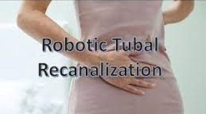 Robotic Tubal Recanalization, Tubal Sterilization Reversal or Tubal Ligation Reversal