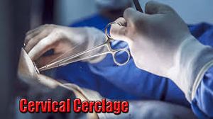 Laparoscopic cervical cerclage