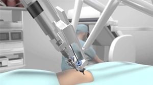 Robotic Hysterectomy