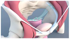 Laparoscopic management of genitourinary prolapse