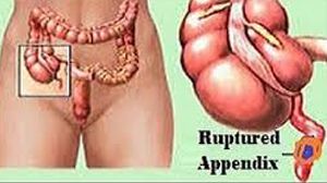 Errors in Laparoscopic Surgery: A Surgeon's Guide to Minimizing Risk and Maximizing Patient Safety