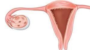 Laparoscopic Myomectomy for Posterior Wall Fibroid Uterus with Endometriosis (4 K Video)