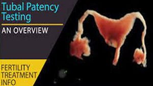 Appendectomy lecture New in Full HD - Dr R K Mishra