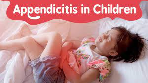 Appendicectomy for Appendicitis in child - Pediatric Appendix