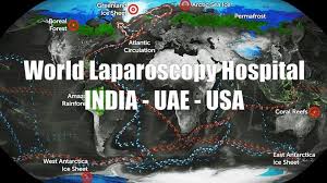 Port Position in Laparoscopy - Baseball Diamond Concept by Dr R K Mishra