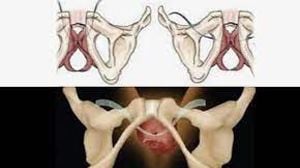 Total Laparoscopic Hysterectomy by Dr R K Mishra