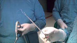 Laparoscopic orchiectomy combined with hernia repair