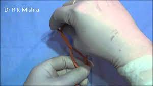 Three-Port Total Laparoscopic Hysterectomy (TLH) with Infrared Ureteric Catheter