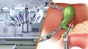 Laparoscopic Anatomy of Pelvis by Dr R K Mishra