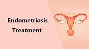 Laparoscopic Surgery for Large Intramural Fibroid Uterus