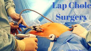 Laparoscopic Ventral Hernia repair by Dr R K Mishra