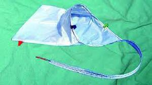 Laparoscopic Cervical Cerclage with Myomectomy Offers Minimally Invasive Solutions