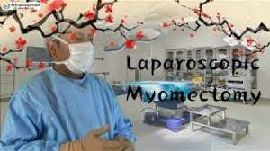 Laparoscopic Myomectomy HD Video for Multiple Myoma using Mishra's Knot