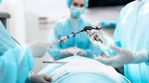Laparoscopic Myomectomy for Large Broad ligament Fibroid