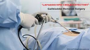 Laparoscopic Cholecystectomy in Cirrhosis Patient