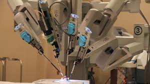 da vinci robotic repair of bilateral direct recurrent inguinal hernia