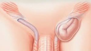 Laparoscopic Cervical Cerclage with Myomectomy Offers Minimally Invasive Solutions