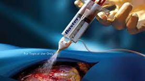 Advancing Women's Health: Laparoscopic Surgery for Endometrial Cyst Treatment