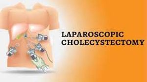 International Patients at World Laparoscopy Hospital