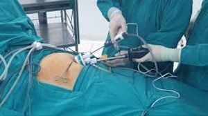 Laparoscopic Repair of Epigastric Hernia by Two Ports