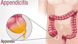 Endoscopy - Upper GI Endoscopy and Colonoscopy