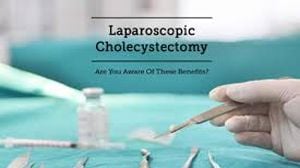 Laparoscopic Cholecystectomy using Mishra's Knot