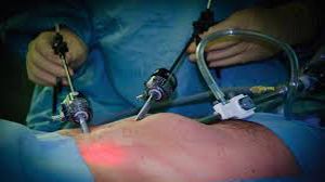 TLH + Sacrocolpopexy Skin to Skin Surgical Video