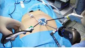 Exploring the International Laparoscopic Training Institute at World Laparoscopy Hospital