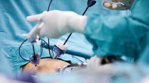 Fellowship in Minimal Access Surgery from USA