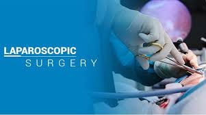 Bilateral Salpingectomy with Appendicectomy - Dr R K Mishra