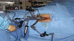 Transanal Endoscopic Miscrosurgery