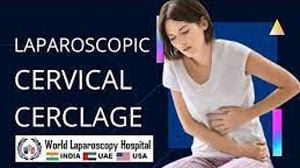 Laparoscopic cervical Cerclage Surgery for Cervical Insufficiency