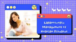 Laparoscopic Management of Ovarian Diseases DR RK Mishra Live Stream