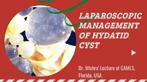 Laparoscopy Mastery: Filling the Gaps in My General Surgery Knowledge Through Training