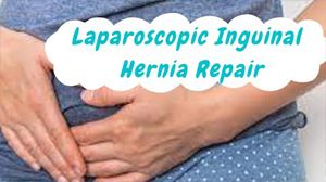 Laparoscopic TAPP Repair of Indirect Inguinal Hernia