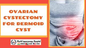 Laparoscopic Surgery for Left Ovarian Dermoid Cyst