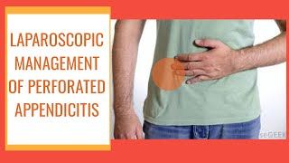 Laparoscopic Management of Perforated Appendicitis