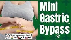 Mini Gastric Bypass for Morbid Obesity