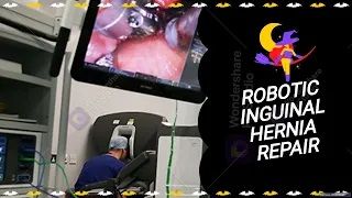 Laparoscopic Dissection Techniques Part 1