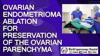 Total Laparoscopic Hysterectomy with ligation of Uterine Artery by Mishra's Knot