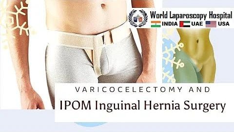 Right Sided IPOM Inguinal Hernia Repair with Left Sided Varicocelectomy
