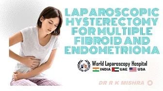 Laparoscopic Hysterectomy for Multiple Fibroid and Endometrioma