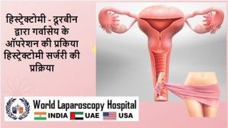 Salpingo Oophorectomy for Large Ovarian Cyst