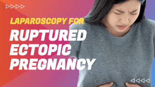 Laparoscopic Repair of Common bile duct (CBD) injury