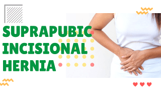 Suprapubic Incisional Hernia Repair