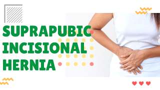 What is the difference in laparoscopic and robotic surgery?