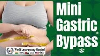 Laparoscopic Repair of Duodenal Perforation Lecture by Dr R K Mishra
