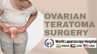 Laparoscopic Resection of a Torted Ovarian Dermoid Cyst